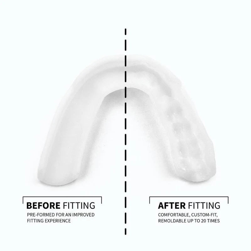 SOVA 3D Night Guard | Teeth Grinding Guard for Moderate Bruxism