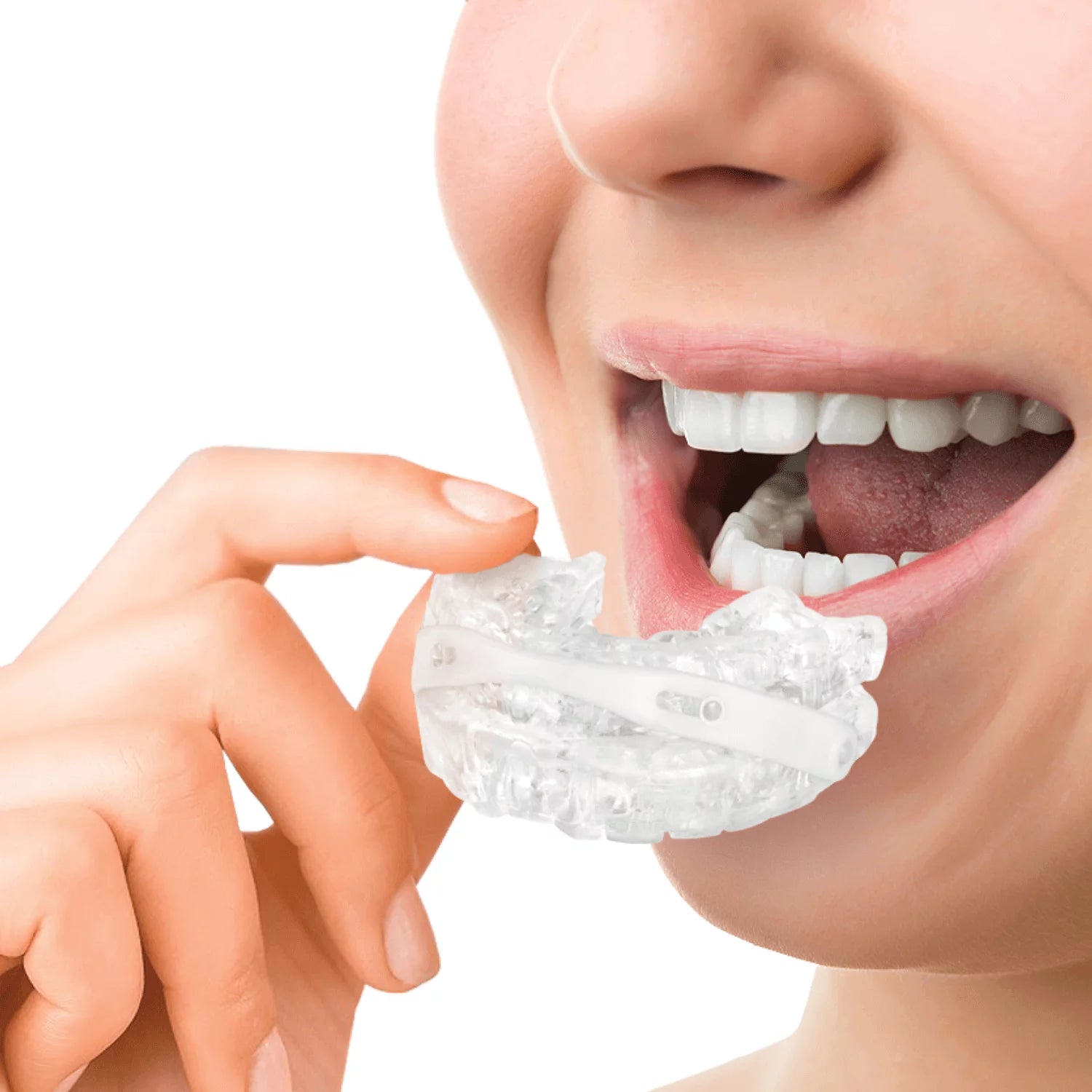Somnofit Anti-Snoring Mouthguard | Mandibular Advancement Device