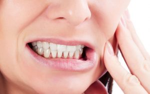 bruxism sova night guard