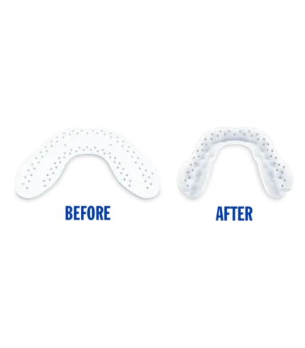 LunaGuard Nighttime Teeth Grinding & Clenching Dental Mouth Guard (10)
